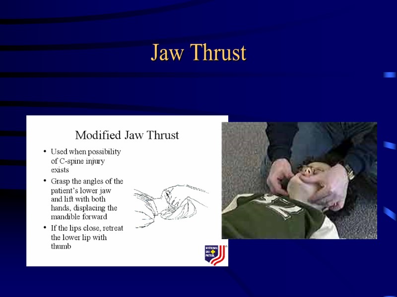 Jaw Thrust